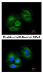 SIRT3 Antibody in Immunocytochemistry (ICC/IF)