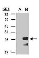 RGS19 Polyclonal Antibody