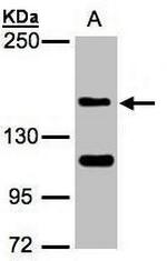 NSD2 Antibody in Western Blot (WB)