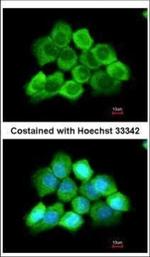 CENTG3 Antibody in Immunocytochemistry (ICC/IF)