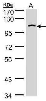 CENTG3 Antibody in Western Blot (WB)
