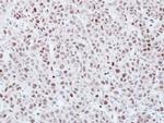 KPNA3 Antibody in Immunohistochemistry (Paraffin) (IHC (P))
