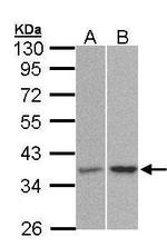 PP2A alpha Antibody in Western Blot (WB)