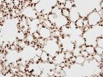 BAF57 Antibody in Immunohistochemistry (Paraffin) (IHC (P))