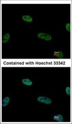 TRIP15 Polyclonal Antibody