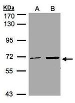 CDYL Antibody in Western Blot (WB)