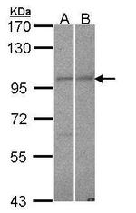 RANBP9 Polyclonal Antibody