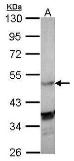 LXR alpha Polyclonal Antibody