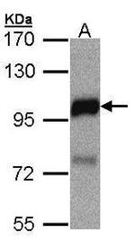 DLC1 Antibody in Western Blot (WB)