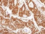 PPP2R5D Antibody in Immunohistochemistry (Paraffin) (IHC (P))