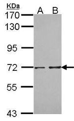 PPP2R5D Antibody in Western Blot (WB)