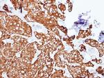 PCID1 Antibody in Immunohistochemistry (Paraffin) (IHC (P))