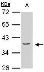 PCID1 Antibody in Western Blot (WB)