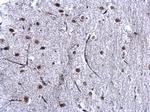 HP1 beta Antibody in Immunohistochemistry (Paraffin) (IHC (P))