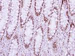 NUP50 Antibody in Immunohistochemistry (Paraffin) (IHC (P))