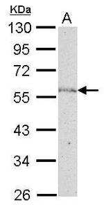 NUP50 Antibody in Western Blot (WB)