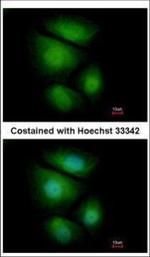 RNF13 Polyclonal Antibody