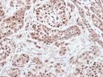 RNF13 Antibody in Immunohistochemistry (Paraffin) (IHC (P))