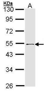 RNF13 Antibody in Western Blot (WB)