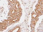 CCNDBP1 Polyclonal Antibody