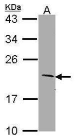 SERTAD1 Antibody in Western Blot (WB)