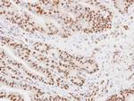 MKRN1 Polyclonal Antibody