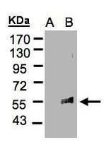 FLVCR1 Polyclonal Antibody