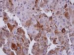 UBE2T Antibody in Immunohistochemistry (Paraffin) (IHC (P))