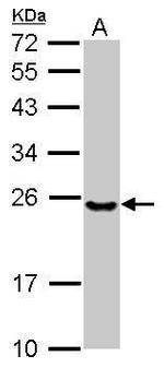 UBE2T Antibody in Western Blot (WB)