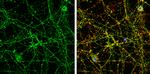 SH3GL2 Antibody in Immunocytochemistry (ICC/IF)