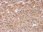 CESK1 Polyclonal Antibody