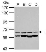 CESK1 Antibody in Western Blot (WB)