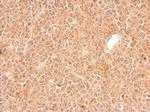 GGPS1 Polyclonal Antibody