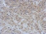 RAP1GDS1 Antibody in Immunohistochemistry (Paraffin) (IHC (P))