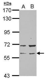 RAP1GDS1 Antibody in Western Blot (WB)