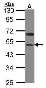 GRINL1A Polyclonal Antibody