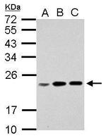 RPL17P7 Antibody in Western Blot (WB)