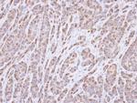 p40 Antibody in Immunohistochemistry (Paraffin) (IHC (P))