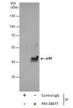 p40 Antibody in Immunoprecipitation (IP)