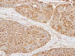 MRPS22 Antibody in Immunohistochemistry (Paraffin) (IHC (P))