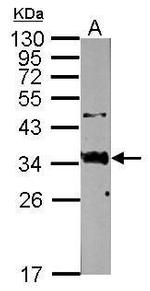 SFTPA1 Polyclonal Antibody
