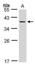 AKR7A3 Antibody in Western Blot (WB)