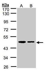 ERP44 Antibody in Western Blot (WB)