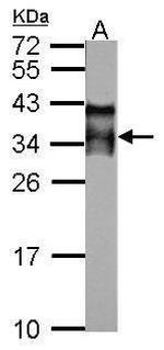 Acrosomal Vesicle Protein Polyclonal Antibody