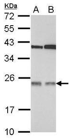 p27 Polyclonal Antibody
