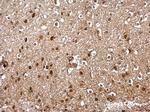 SKP1 Polyclonal Antibody