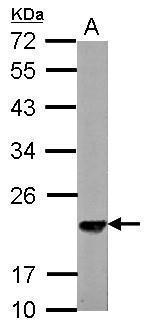 SKP1 Antibody in Western Blot (WB)