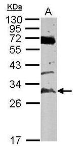 TATDN3 Antibody in Western Blot (WB)