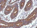 CCDC37 Polyclonal Antibody
