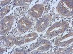 HAUS4 Polyclonal Antibody